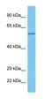 Uncharacterized protein C9orf85 homolog antibody, orb325862, Biorbyt, Western Blot image 