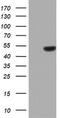 Zinc Finger Protein 385B antibody, M12007, Boster Biological Technology, Western Blot image 