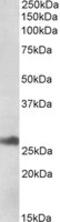 DnaJ Heat Shock Protein Family (Hsp40) Member B9 antibody, MBS422895, MyBioSource, Western Blot image 