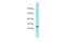 Glycosylphosphatidylinositol-anchored high density lipoprotein-binding protein 1 antibody, A04294, Boster Biological Technology, Western Blot image 