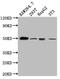 Hepatitis A Virus Cellular Receptor 1 antibody, CSB-RA974628A0HU, Cusabio, Western Blot image 