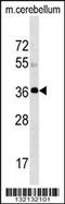 Mitochondrial carnitine/acylcarnitine carrier protein antibody, 60-334, ProSci, Western Blot image 