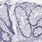 Spectrin Beta, Non-Erythrocytic 5 antibody, PA5-62972, Invitrogen Antibodies, Immunohistochemistry paraffin image 