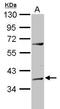 Adenosine Deaminase TRNA Specific 1 antibody, GTX119394, GeneTex, Western Blot image 