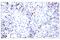 T Cell Receptor Beta Constant 1 antibody, 79485S, Cell Signaling Technology, Immunohistochemistry paraffin image 