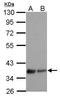 Lysophosphatidic Acid Receptor 3 antibody, GTX100018, GeneTex, Western Blot image 