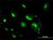 Syntaxin 6 antibody, H00010228-M01, Novus Biologicals, Immunocytochemistry image 