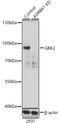 G Protein-Coupled Receptor Kinase 2 antibody, GTX35230, GeneTex, Western Blot image 
