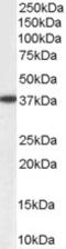 Aldo-Keto Reductase Family 1 Member A1 antibody, 45-237, ProSci, Enzyme Linked Immunosorbent Assay image 