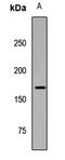 DNA Topoisomerase II Binding Protein 1 antibody, LS-C668199, Lifespan Biosciences, Western Blot image 