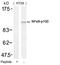 Nuclear Factor Kappa B Subunit 2 antibody, MBS9401153, MyBioSource, Western Blot image 