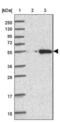 Calcium Binding Tyrosine Phosphorylation Regulated antibody, NBP2-14430, Novus Biologicals, Western Blot image 