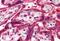 Nei Like DNA Glycosylase 1 antibody, GTX89756, GeneTex, Immunohistochemistry paraffin image 
