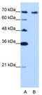 CDKN2A Interacting Protein antibody, TA343857, Origene, Western Blot image 