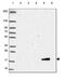 Cytochrome B5 Type A antibody, PA5-63584, Invitrogen Antibodies, Western Blot image 