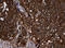 NME/NM23 Nucleoside Diphosphate Kinase 1 antibody, LS-C175602, Lifespan Biosciences, Immunohistochemistry paraffin image 