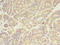 FYN Proto-Oncogene, Src Family Tyrosine Kinase antibody, A59178-100, Epigentek, Immunohistochemistry paraffin image 