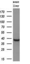 MCL1 Apoptosis Regulator, BCL2 Family Member antibody, GTX84132, GeneTex, Western Blot image 