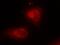 NFKB Inhibitor Alpha antibody, A01139-1, Boster Biological Technology, Immunofluorescence image 