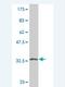 Eukaryotic Translation Initiation Factor 4E Binding Protein 2 antibody, H00001979-M04, Novus Biologicals, Western Blot image 