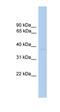 ST6 N-Acetylgalactosaminide Alpha-2,6-Sialyltransferase 6 antibody, orb325304, Biorbyt, Western Blot image 