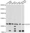 C2 Calcium Dependent Domain Containing 5 antibody, A12123, Boster Biological Technology, Western Blot image 