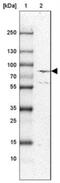 Endothelin Converting Enzyme 1 antibody, NBP1-84017, Novus Biologicals, Western Blot image 