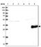 Myozenin 3 antibody, NBP1-90616, Novus Biologicals, Western Blot image 