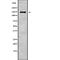 ATP Binding Cassette Subfamily B Member 11 antibody, abx147866, Abbexa, Western Blot image 