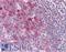 TNF Superfamily Member 14 antibody, LS-B15594, Lifespan Biosciences, Immunohistochemistry paraffin image 