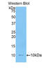 Interleukin 6 Receptor antibody, LS-C298629, Lifespan Biosciences, Western Blot image 