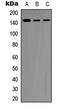 Inositol Polyphosphate-5-Phosphatase D antibody, LS-C368981, Lifespan Biosciences, Western Blot image 