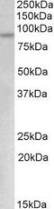 MYB Proto-Oncogene, Transcription Factor antibody, GTX88080, GeneTex, Western Blot image 