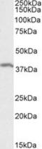 Single-Strand-Selective Monofunctional Uracil-DNA Glycosylase 1 antibody, NB100-1414, Novus Biologicals, Western Blot image 