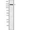 Voltage-gated sodium channel subunit alpha Nav1.9 antibody, abx218455, Abbexa, Western Blot image 