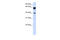 Dystrobrevin beta antibody, 26-124, ProSci, Western Blot image 