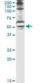 Serine/Threonine Kinase 25 antibody, H00010494-M02, Novus Biologicals, Immunoprecipitation image 