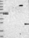 N(Alpha)-Acetyltransferase 40, NatD Catalytic Subunit antibody, NBP1-92168, Novus Biologicals, Western Blot image 