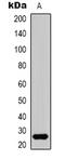 High Mobility Group Box 1 antibody, orb339063, Biorbyt, Western Blot image 