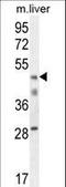 H2A Histone Family Member Y2 antibody, LS-C166761, Lifespan Biosciences, Western Blot image 