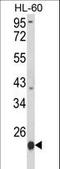 Proteasome Subunit Beta 9 antibody, LS-B13227, Lifespan Biosciences, Western Blot image 