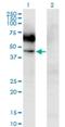 Colony Stimulating Factor 2 Receptor Alpha Subunit antibody, H00001438-M03, Novus Biologicals, Western Blot image 