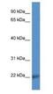 CD99 Molecule Like 2 antibody, NBP1-79854, Novus Biologicals, Western Blot image 