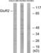 Glutamate Ionotropic Receptor AMPA Type Subunit 2 antibody, LS-C118130, Lifespan Biosciences, Western Blot image 
