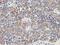 Lactamase Beta 2 antibody, LS-C172757, Lifespan Biosciences, Immunohistochemistry paraffin image 