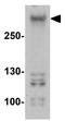 Teneurin Transmembrane Protein 3 antibody, GTX31616, GeneTex, Western Blot image 