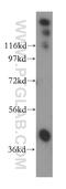Annexin A9 antibody, 15416-1-AP, Proteintech Group, Western Blot image 