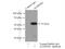 Aldehyde Dehydrogenase 1 Family Member B1 antibody, 15560-1-AP, Proteintech Group, Immunoprecipitation image 