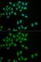 HPS1 Biogenesis Of Lysosomal Organelles Complex 3 Subunit 1 antibody, GTX64776, GeneTex, Immunofluorescence image 