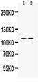 Phosphatidylinositol-4,5-Bisphosphate 3-Kinase Catalytic Subunit Alpha antibody, PB9314, Boster Biological Technology, Western Blot image 